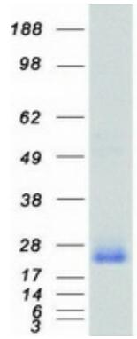 Coomassie blue staining of purified RHOA protein.